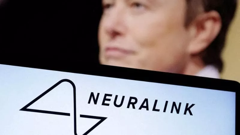 Elon Musk: Primo impianto di Neuralink nel cervello