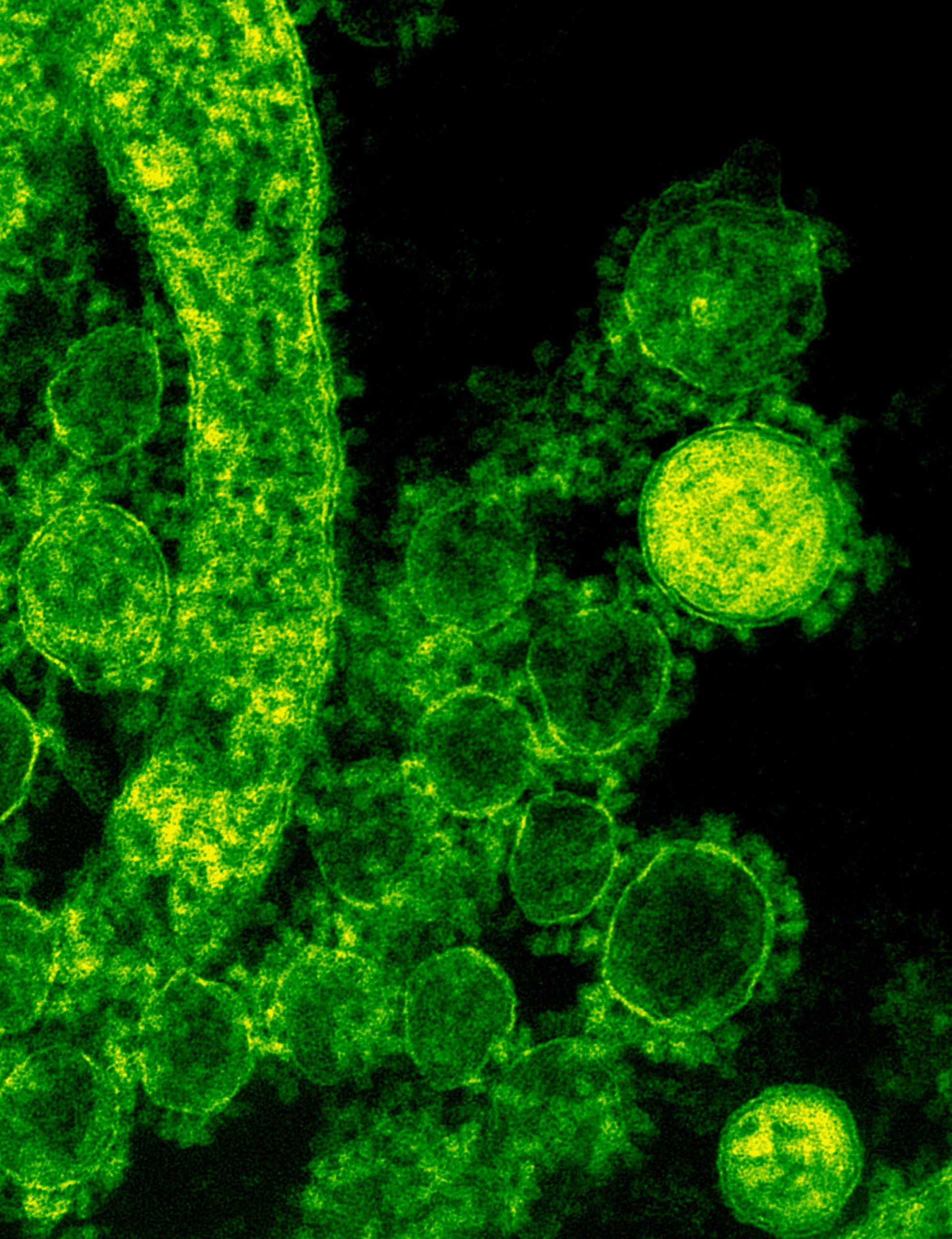 Un'indagine sorprendente: la presenza dei batteri nel liquido seminale e il loro impatto sull'infertilità maschile