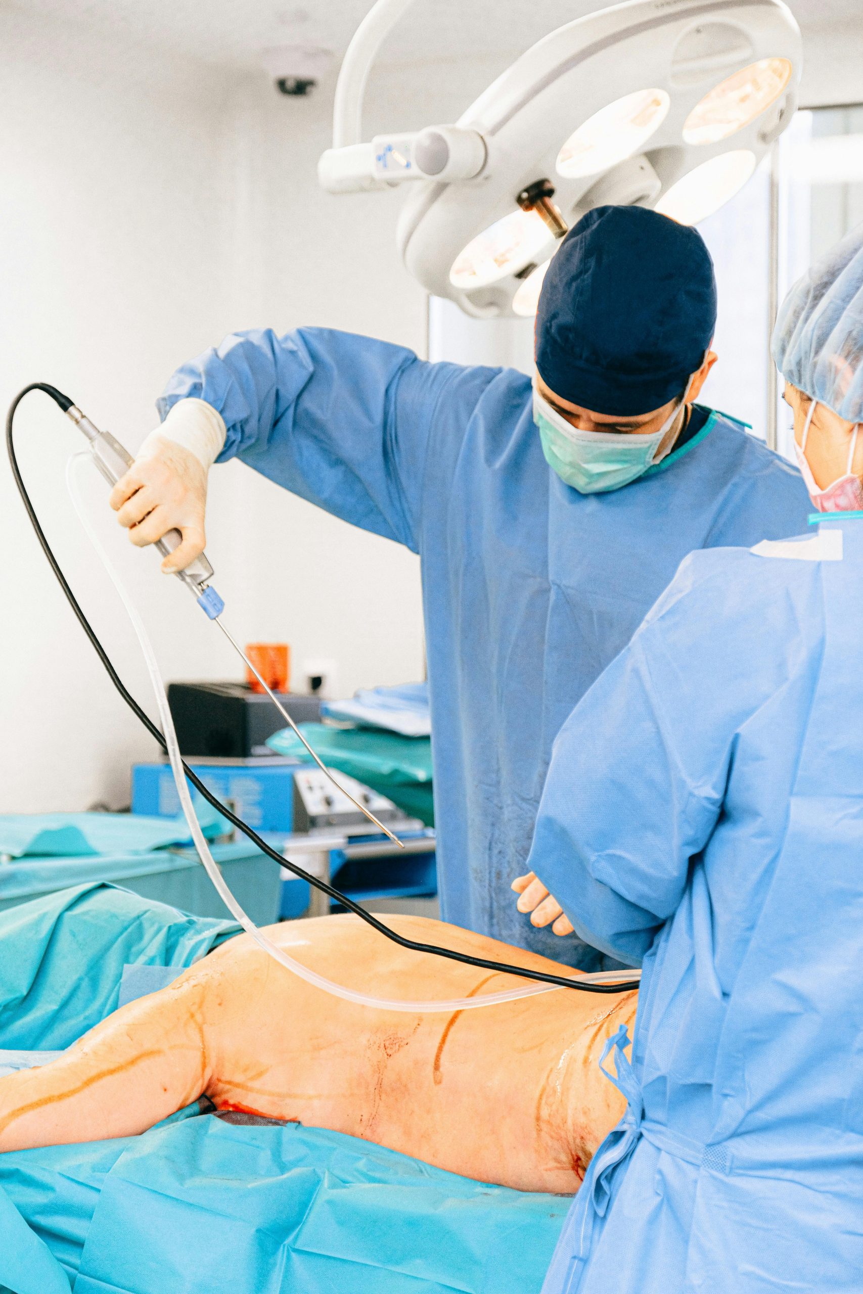 Laparoscopia: La Rivoluzionaria Tecnica Chirurgica Mininvasiva del XXI Secolo