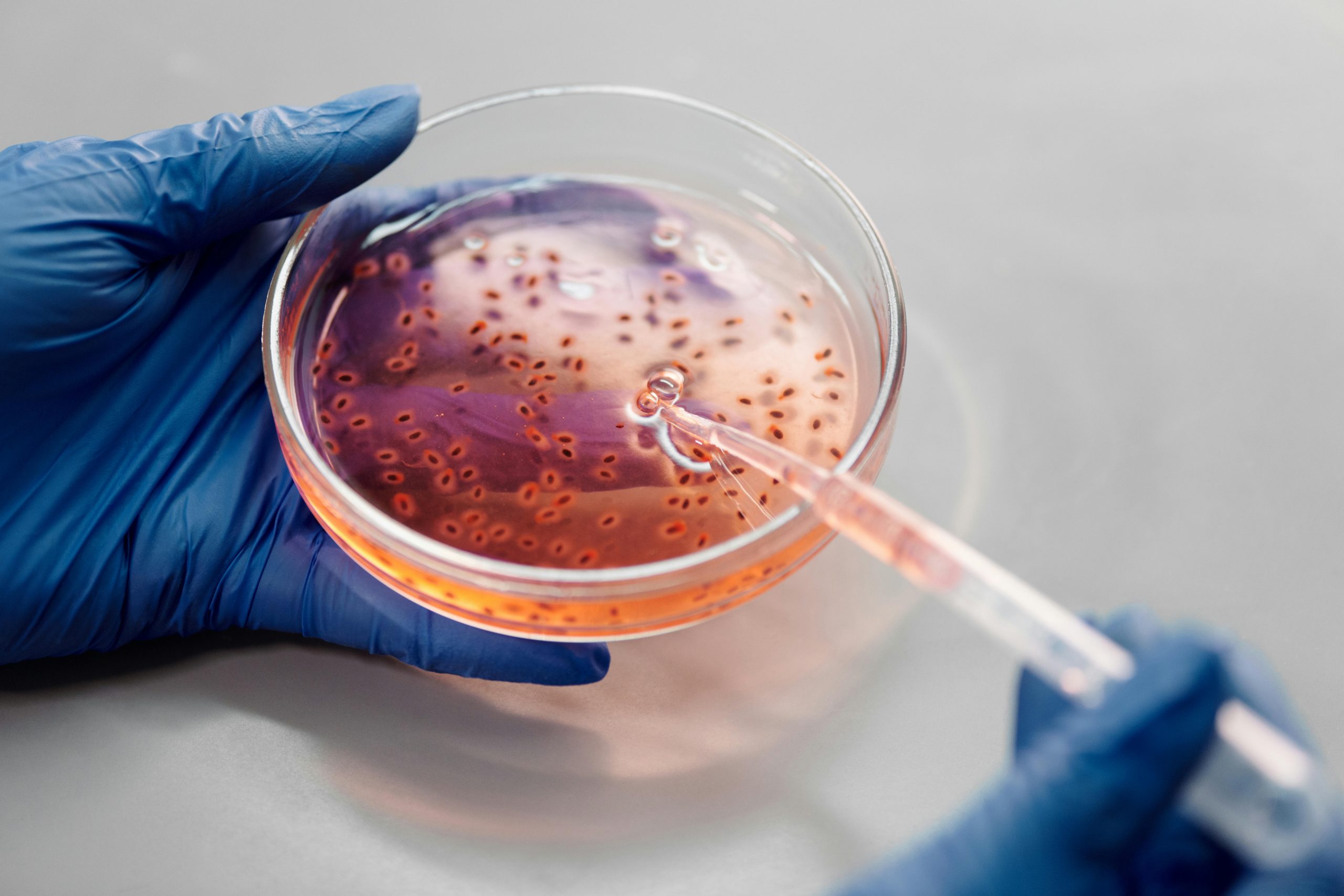 Test Genetici nei Tumori del Colon-Retto: La Chiave per Cure Personalizzate e Precise