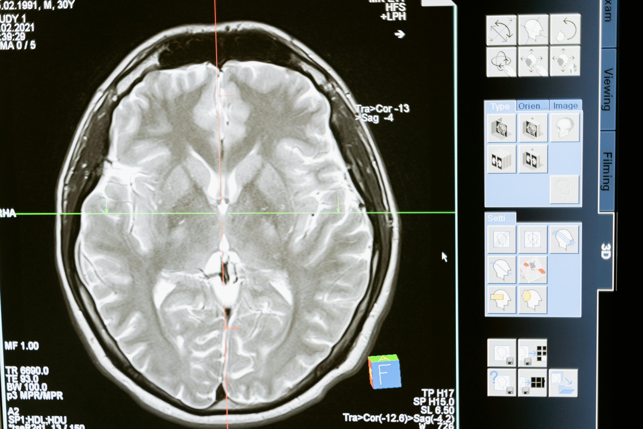 I segreti per mantenere il cervello in salute: consigli per un benessere duraturo