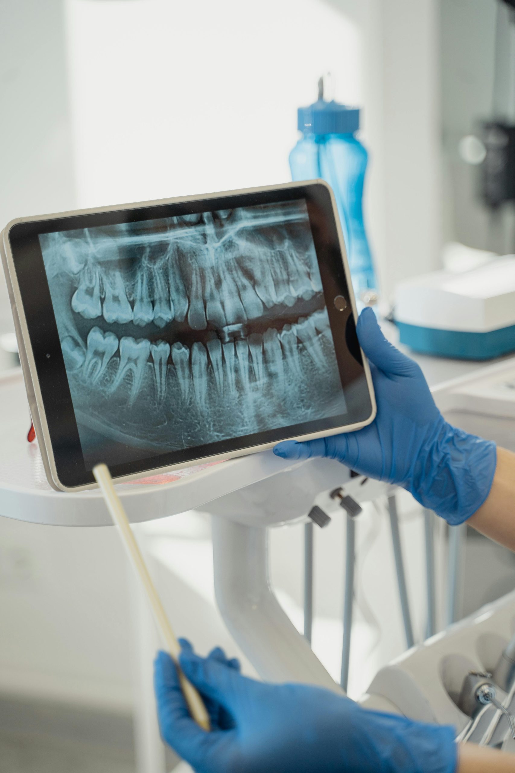 Viaggiare per Cure Dentali: Risparmiare senza Mettere a Rischio la Salute dei Tuoi Denti