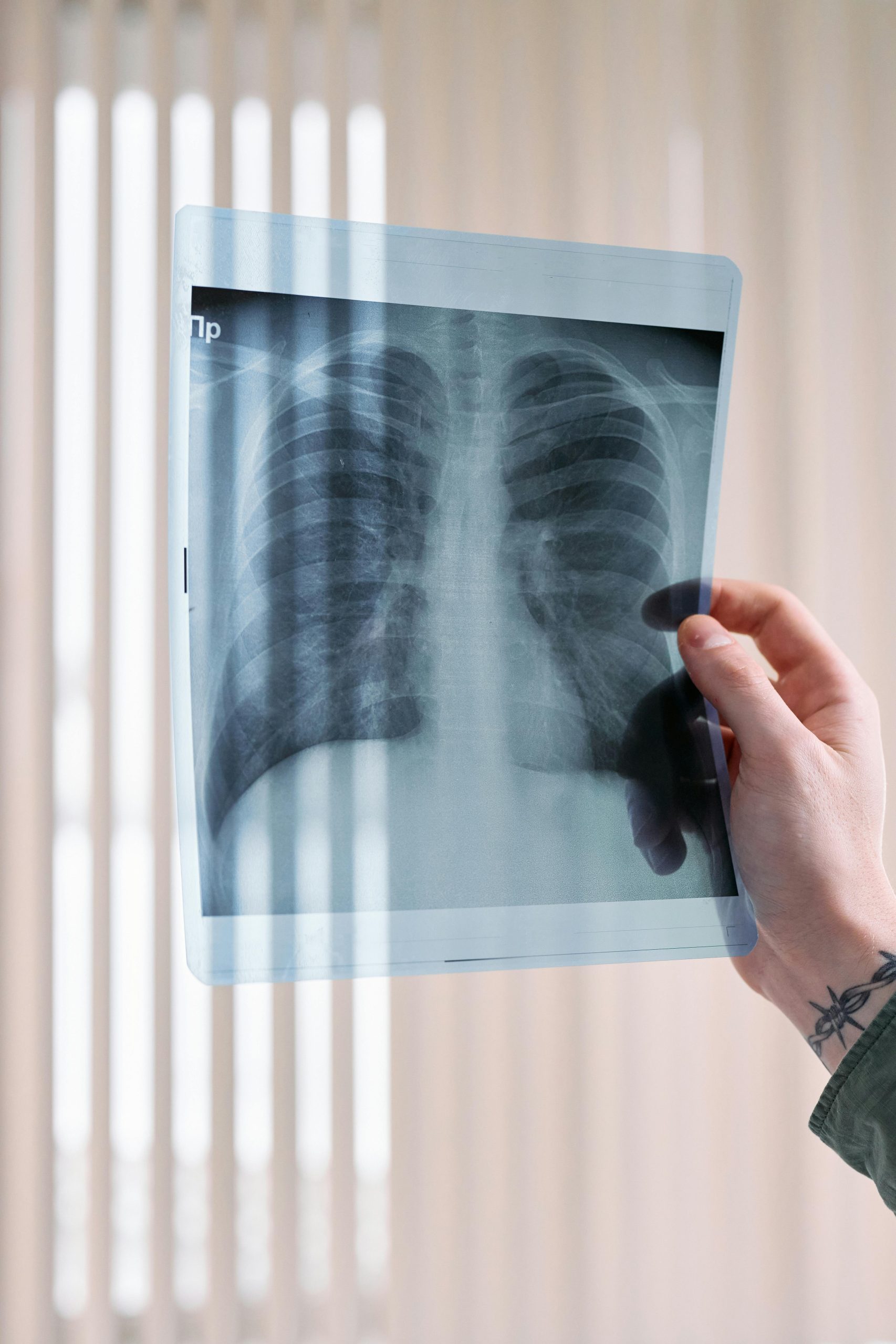Innovativi trattamenti di prima linea per il carcinoma polmonare non a piccole cellule: amivantamab e lazertinib approvati dall'EMA