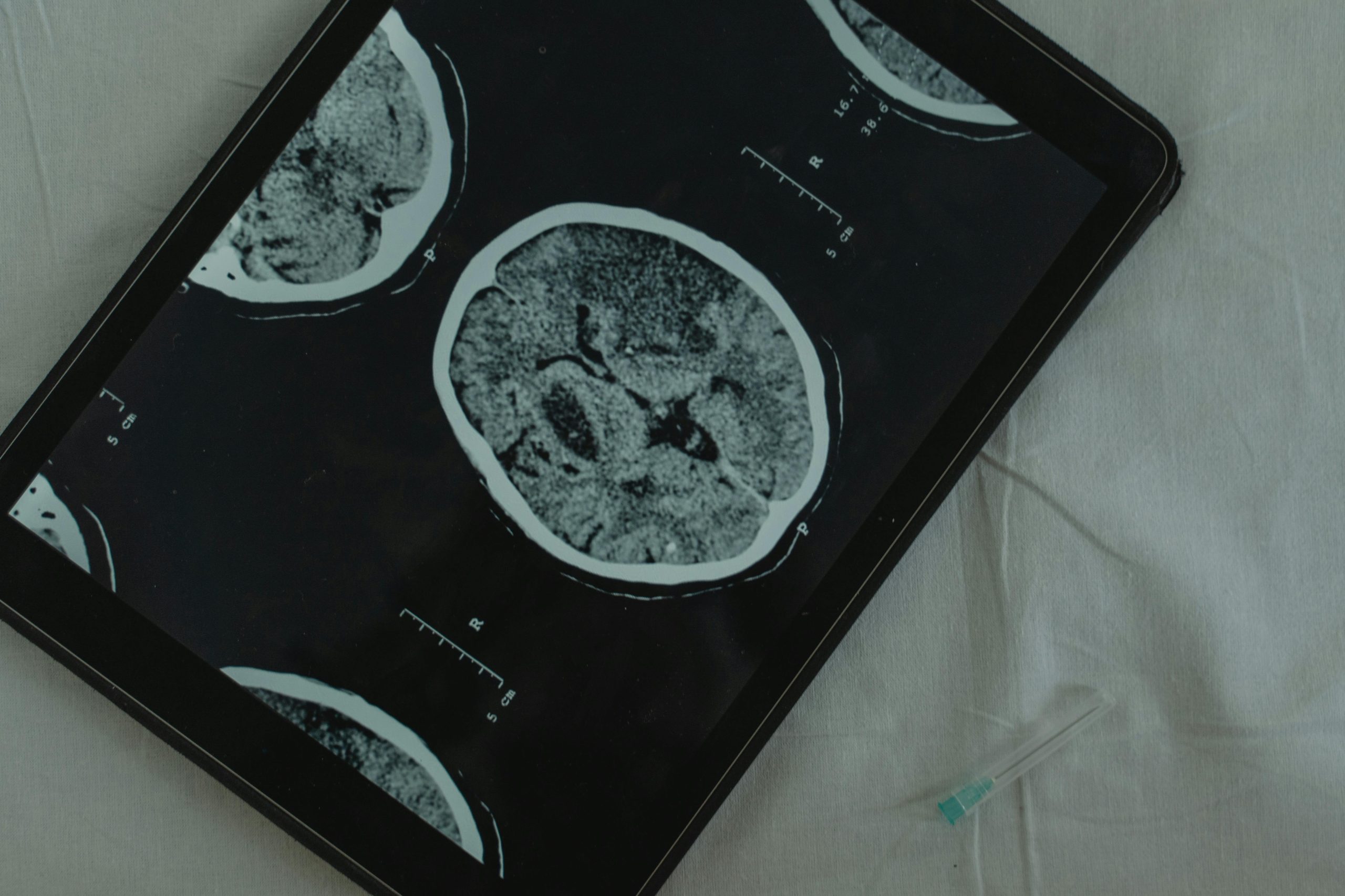 Innovazione in campo medico a Torino: nasce il Centro di Brain Imaging e Risonanza Magnetica 3 Tesla grazie all'accordo tra Città della Salute e l'Università