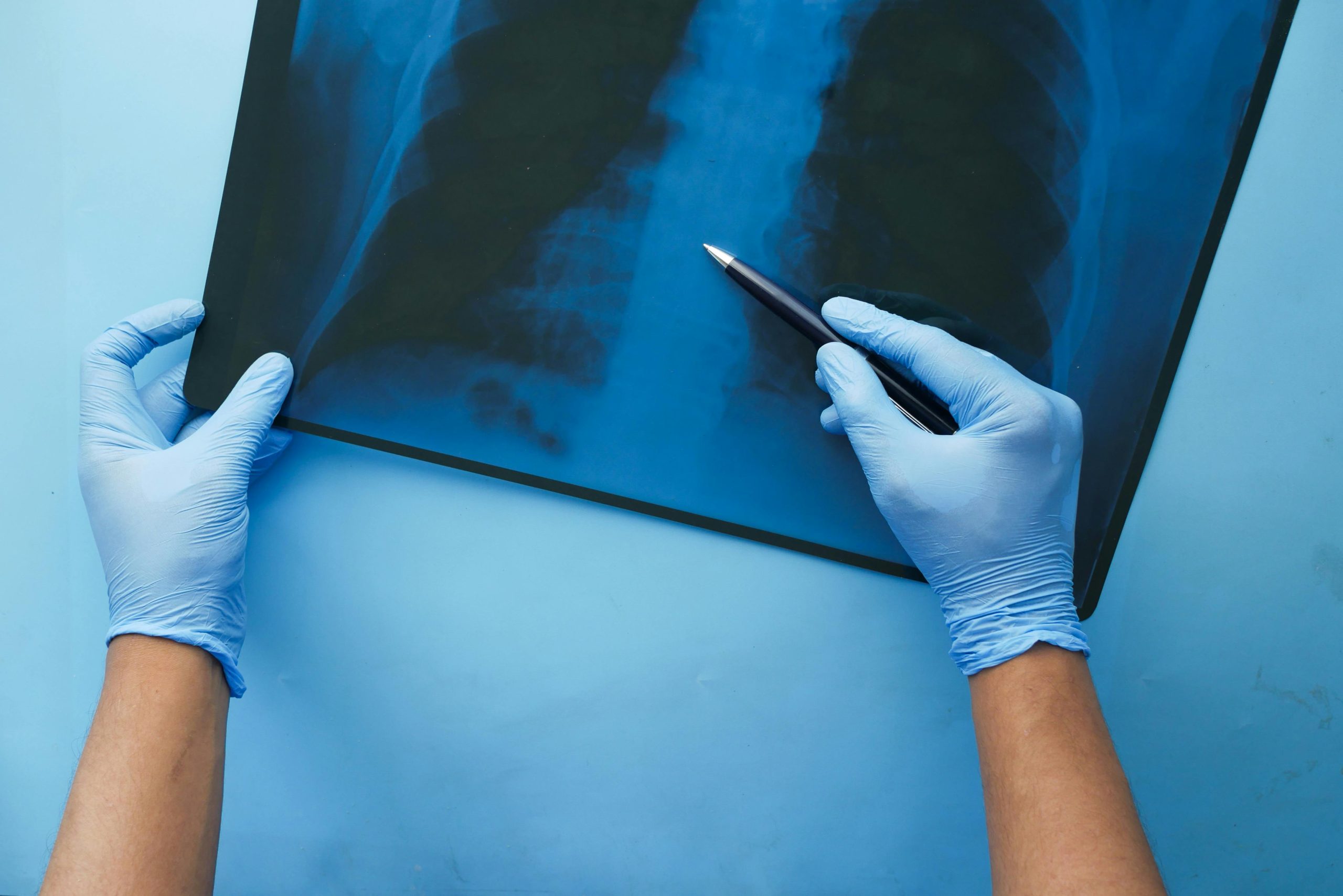 Il Presidente Mattarella sottoposto con successo a un intervento per l'impianto di un pacemaker