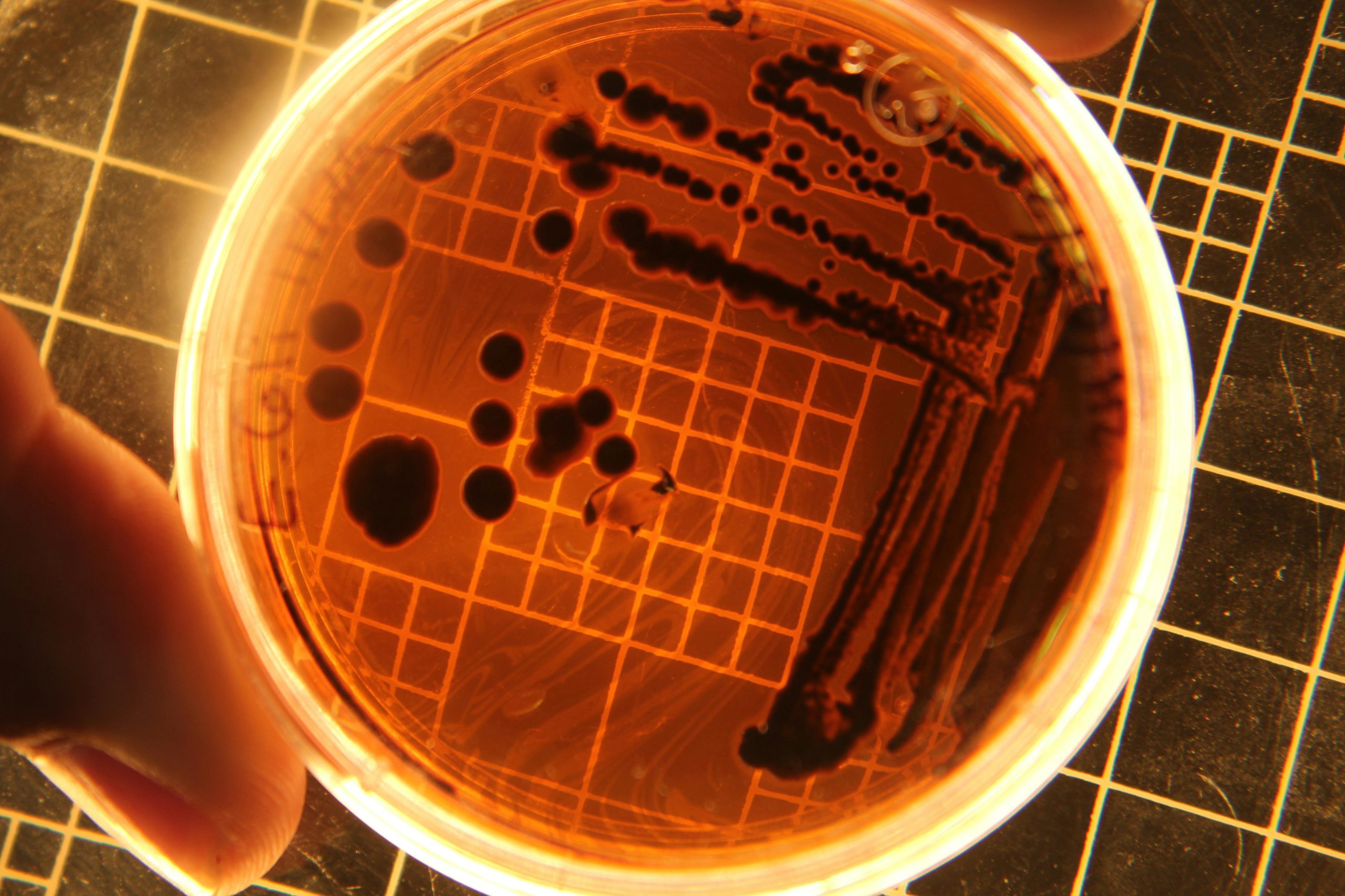 L'incredibile resistenza di Staphylococcus borealis agli antibiotici: un pericolo emergente nella sanità pubblica