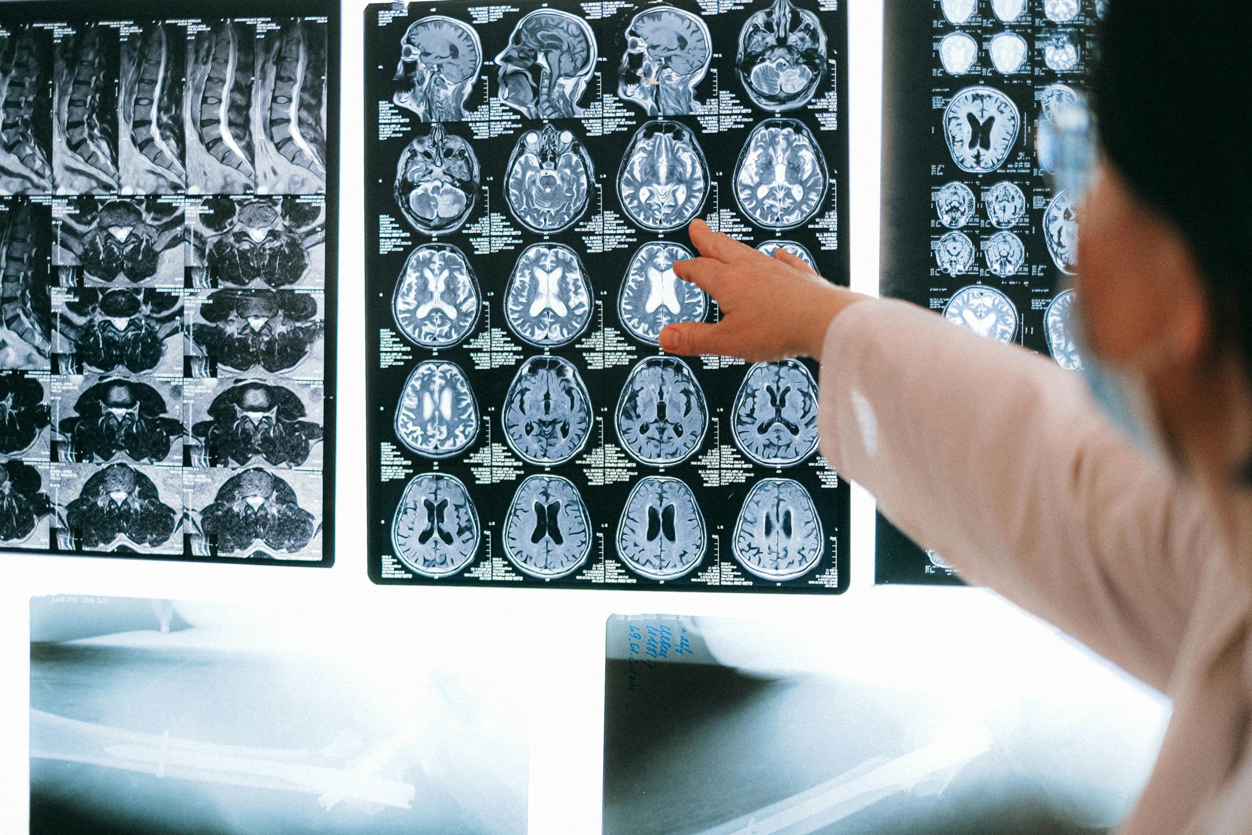 Legge sulla tutela dei lavoratori con patologie gravi: cosa prevede e cosa cambia per i dipendenti