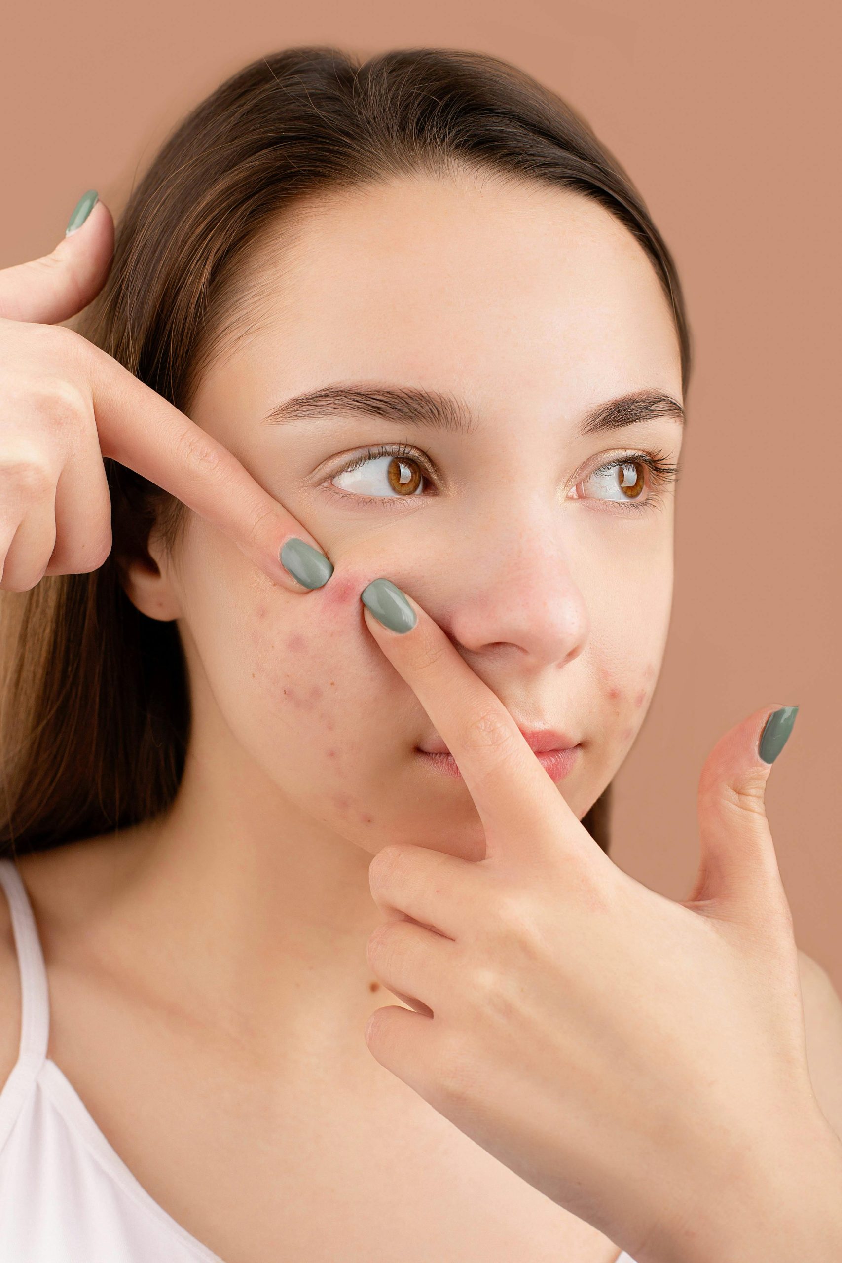 La Dermatite Bovina: Cause, Sintomi e Trattamenti Efficaci per la Salute degli Animali