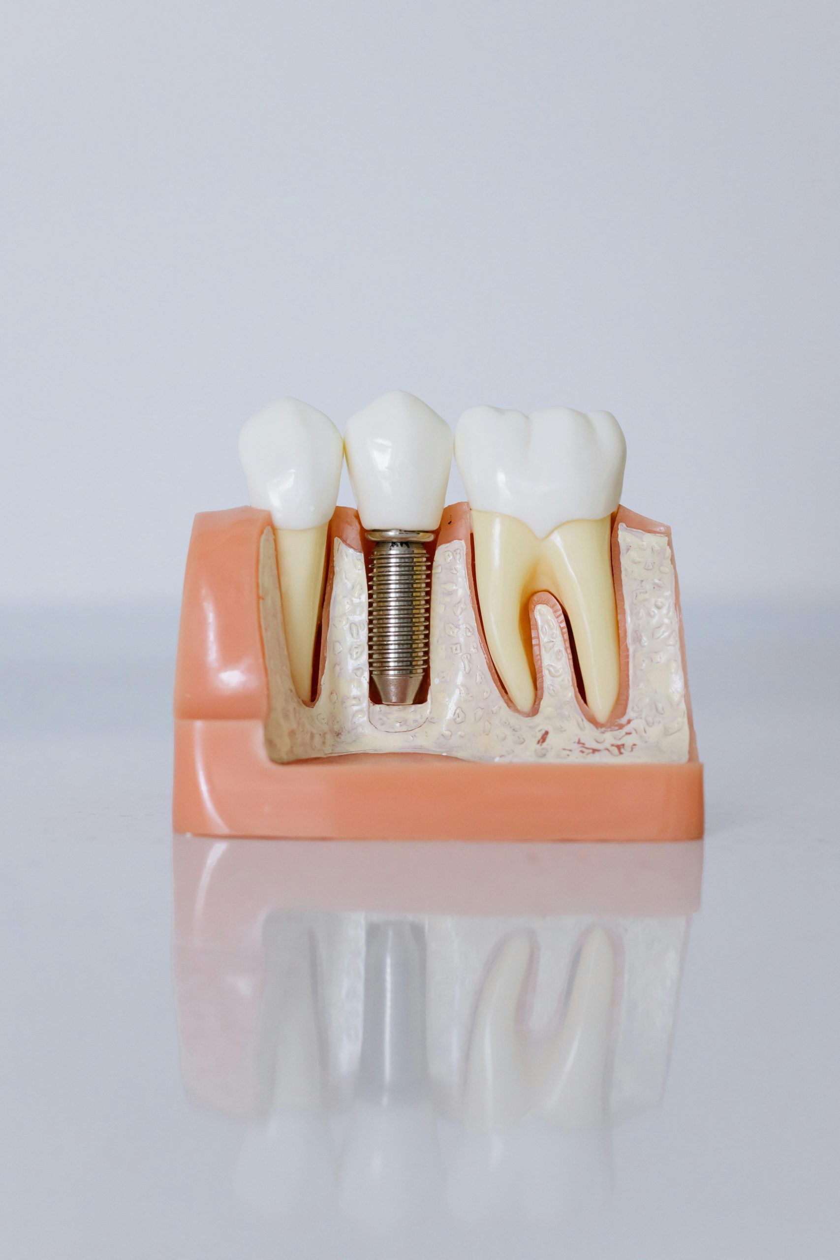 L'Importanza dell'Accreditamento dei Titoli Esterni nel Settore Odontoiatrico: Una Prospettiva Nazionale
